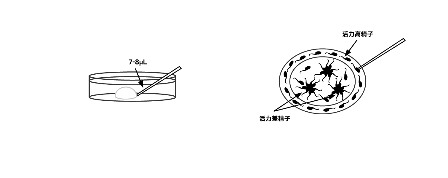 挑选高活力精子